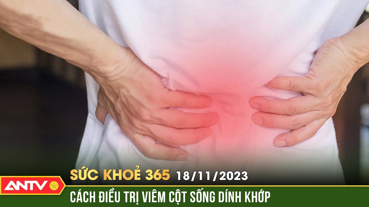 Dấu hiệu của viêm cột sống dính khớp và cách điều trị | Sức khỏe 365 | ANTV