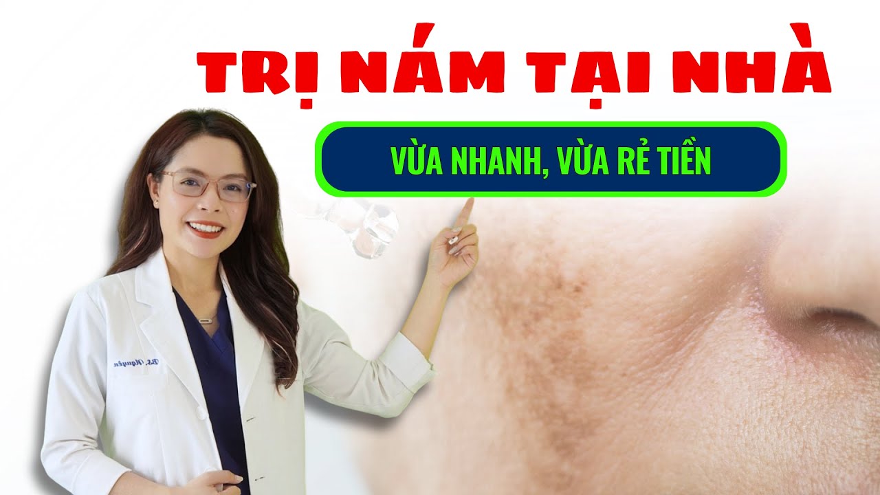 Cách trị nám ngay tại nhà vừa nhanh vừa rẻ tiền - Bác sĩ Nguyên