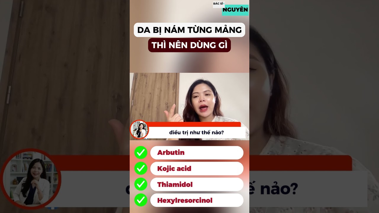 Da bị nám từng mảng, thì nên dùng gì - Bác sĩ Nguyên