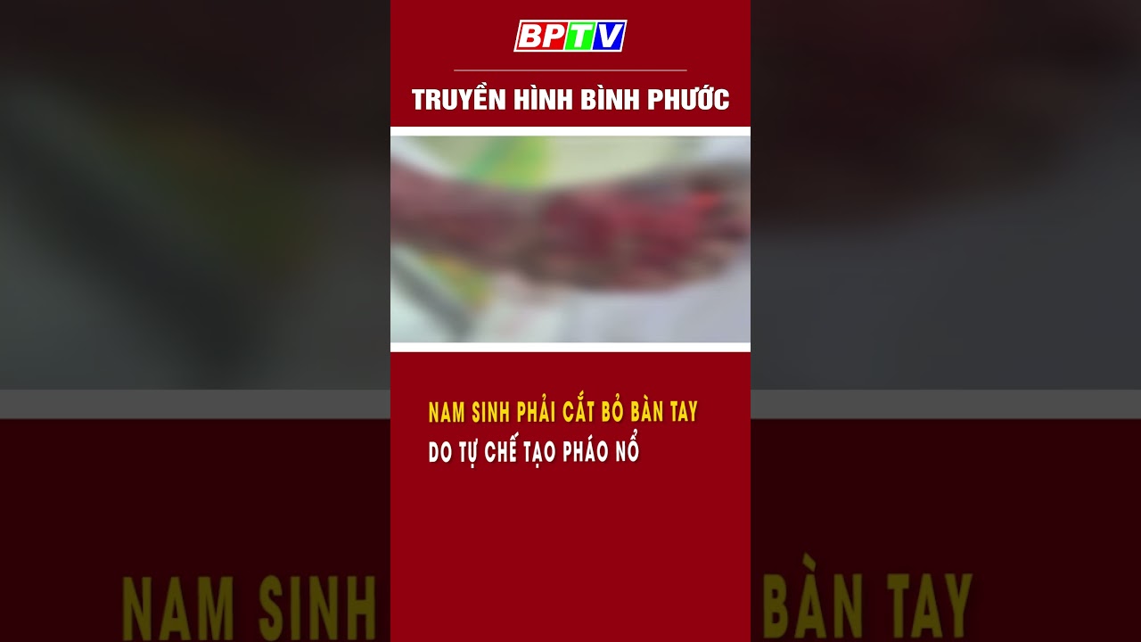 Nam sinh phải cắt bỏ bàn tay do tự chế tạo pháo nổ #shorts  | BPTV