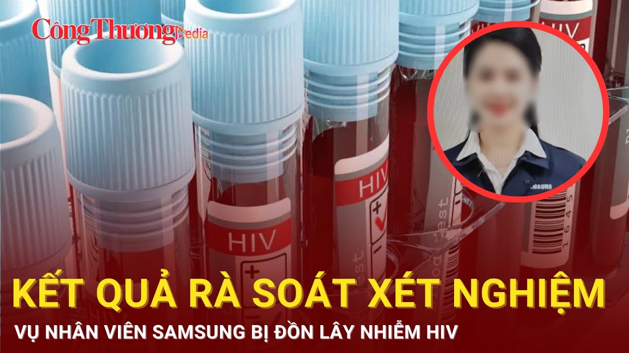 Kết quả rà soát xét nghiệm vụ nhân viên Samsung bị đồn lây nhiễm HIV | Báo Công Thương