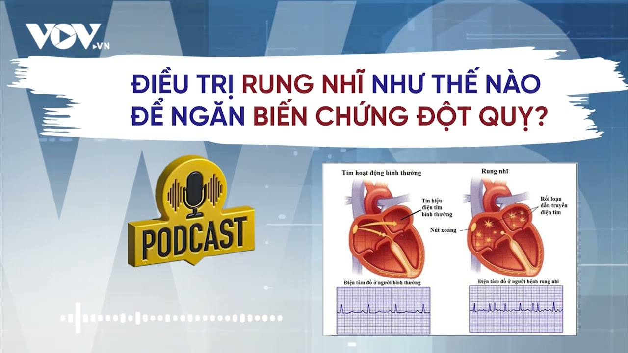 Điều trị rung nhĩ như thế nào để ngăn biến chứng đột quỵ? | Báo Điện tử VOV