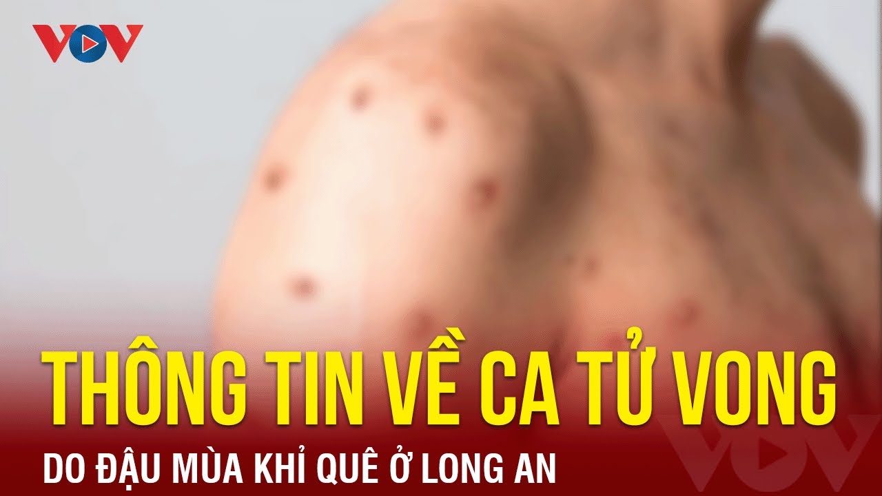 Nam thanh niên tử vong do đậu mùa khỉ quê ở Long An | Báo Điện tử VOV