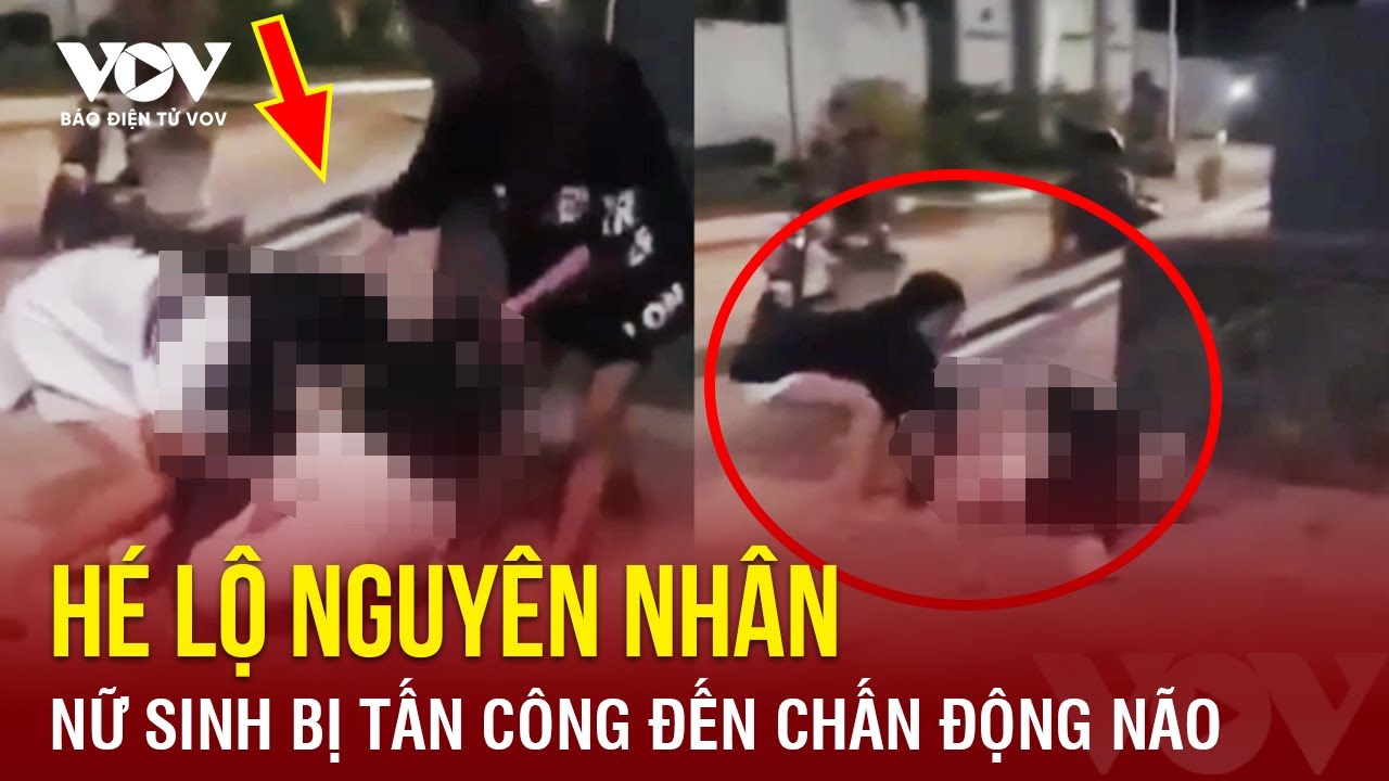 Tối 21/4: Bất ngờ nguyên nhân nữ sinh lớp 6 bị tấn công đến chấn động não | Báo Điện tử VOV