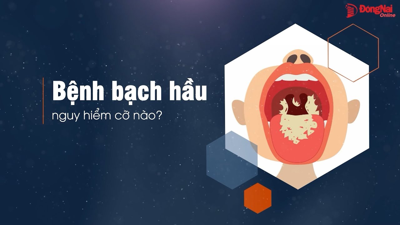 Bệnh bạch hầu nguy hiểm cỡ nào?