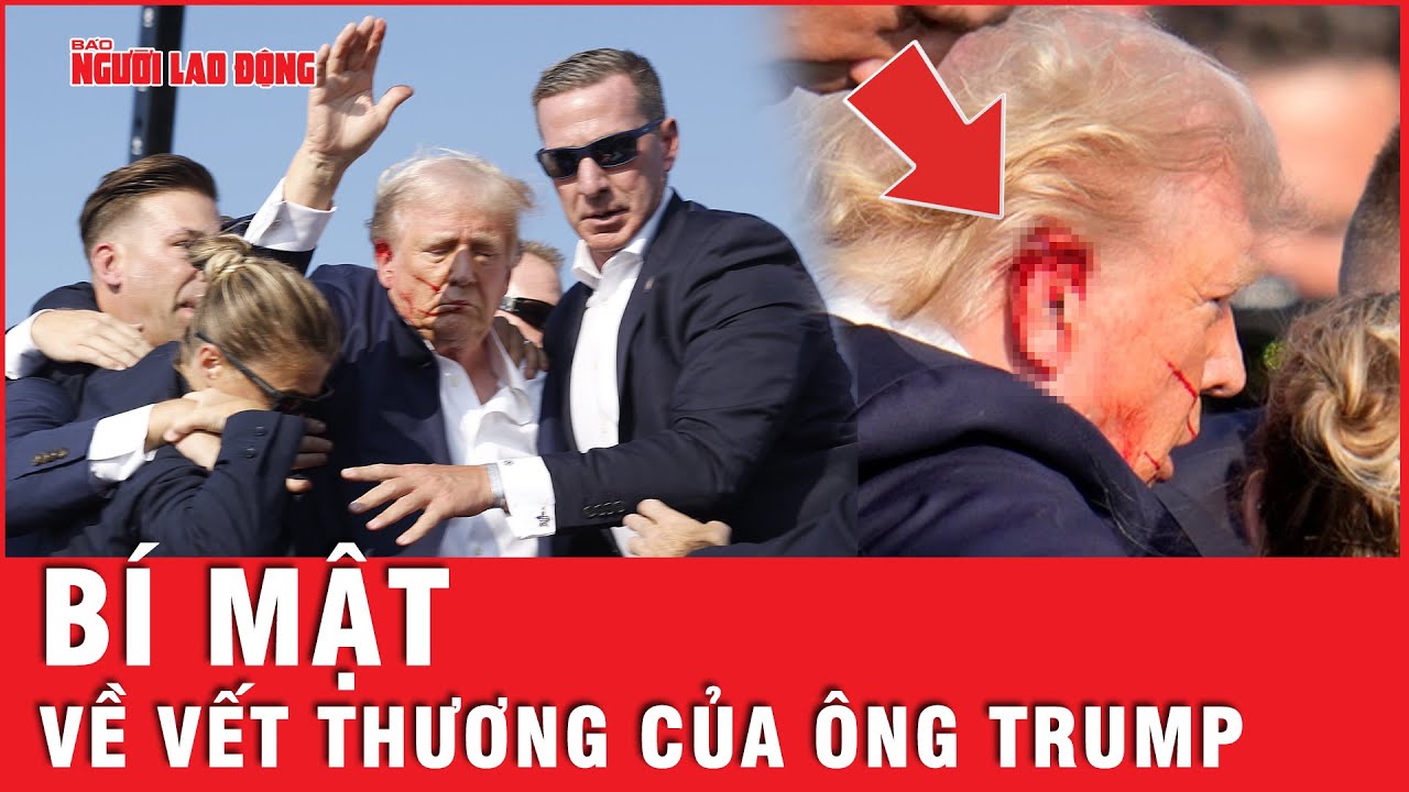 Thông tin về quá trình điều trị và tình trạng vết thương của ông Trump sau vụ ám sát bị bịt kín