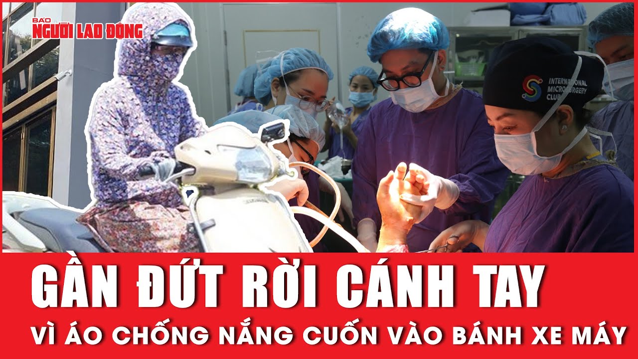 Áo chống nắng cuốn vào bánh xe máy, cô gái 18 tuổi gần đứt rời cánh tay | Báo Người Lao Động