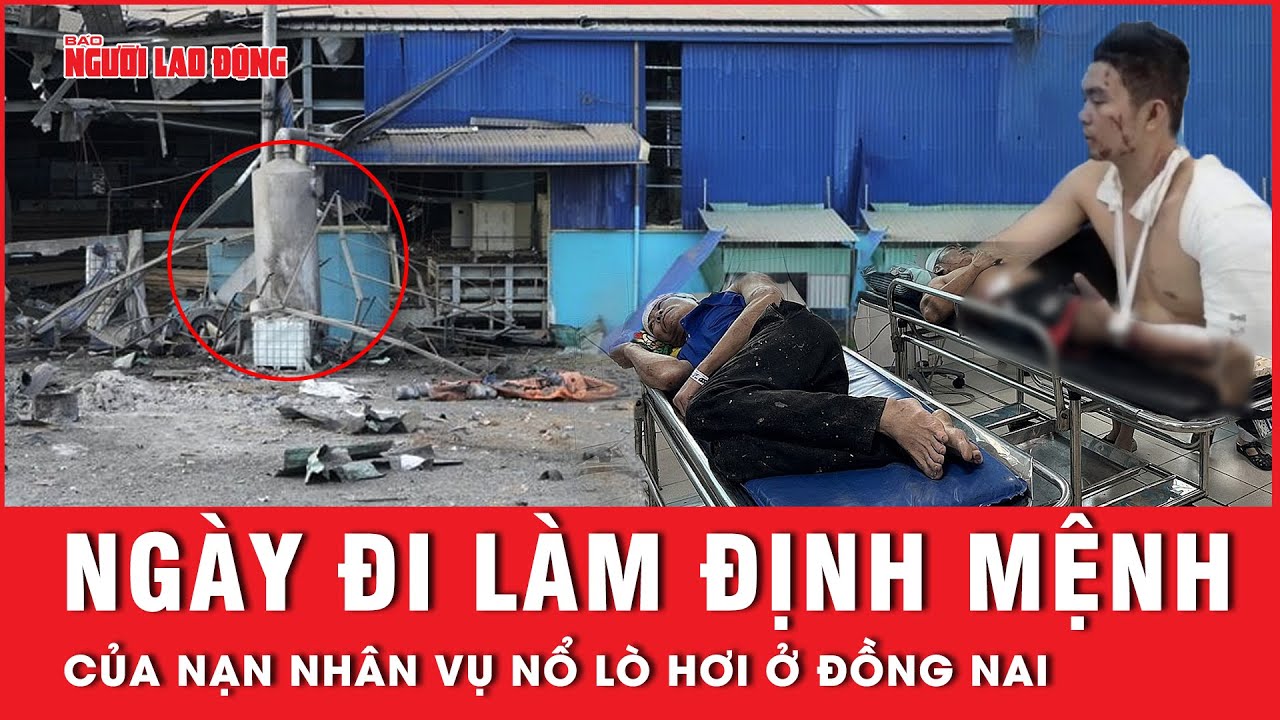 Nạn nhân vụ nổ lò hơi bàng hoàng nhớ lại giây phút sinh tử trong ngày đi làm định mệnh | Tin tức