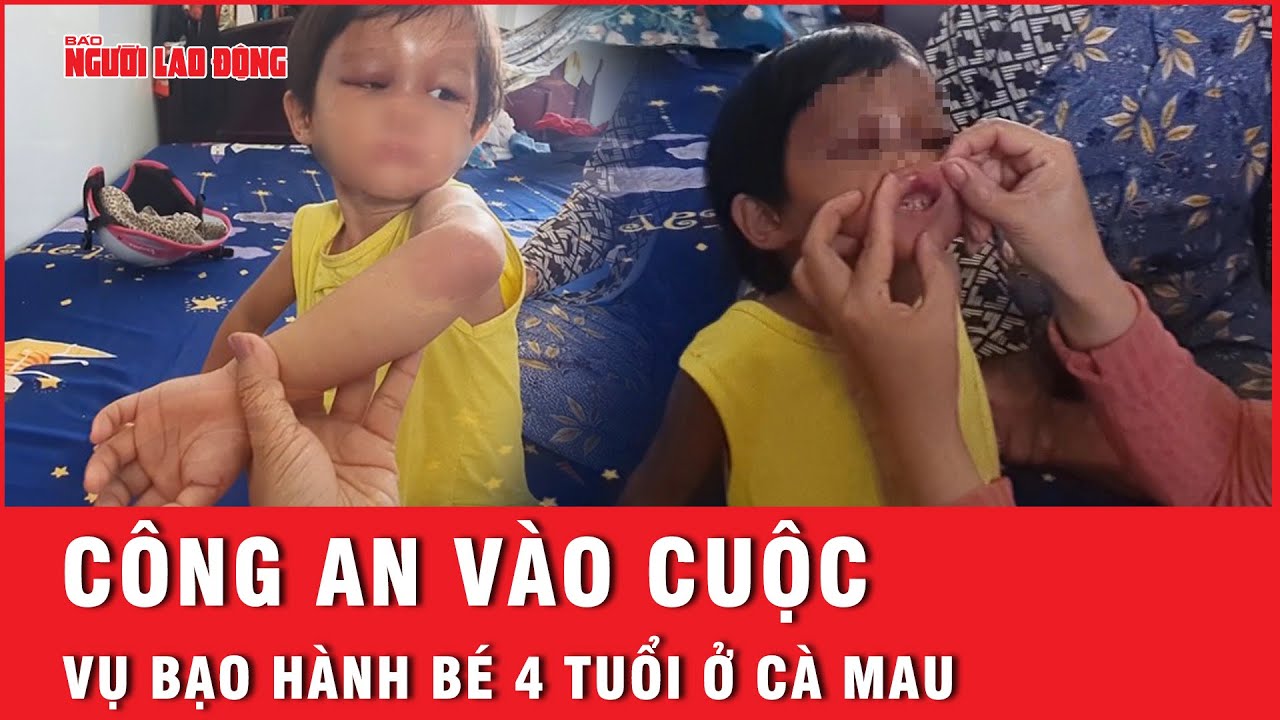 Công an vào cuộc vụ bé 4 tuổi bị cha nuôi tấn công | Tin nhanh