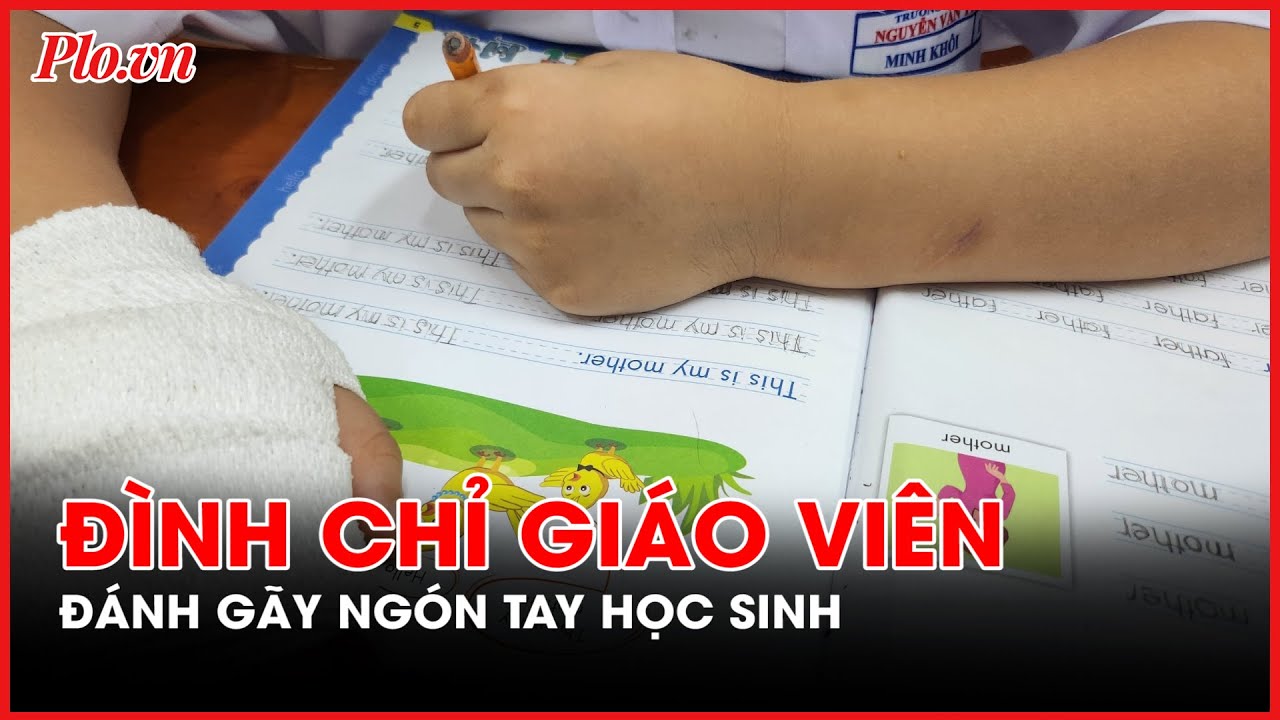 Đình chỉ dạy đối với giáo viên bị tố đánh gãy ngón tay học sinh- PLO