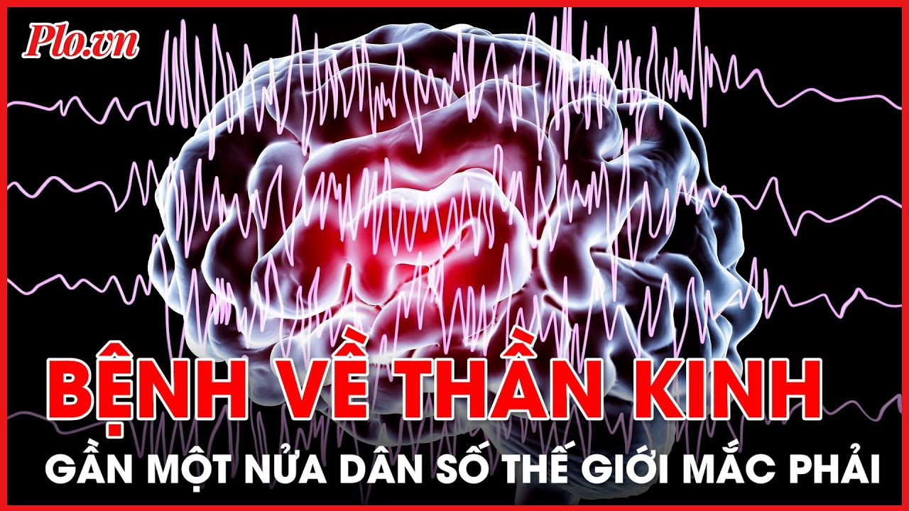 Gần một nửa dân số thế giới mắc bệnh về thần kinh - PLO