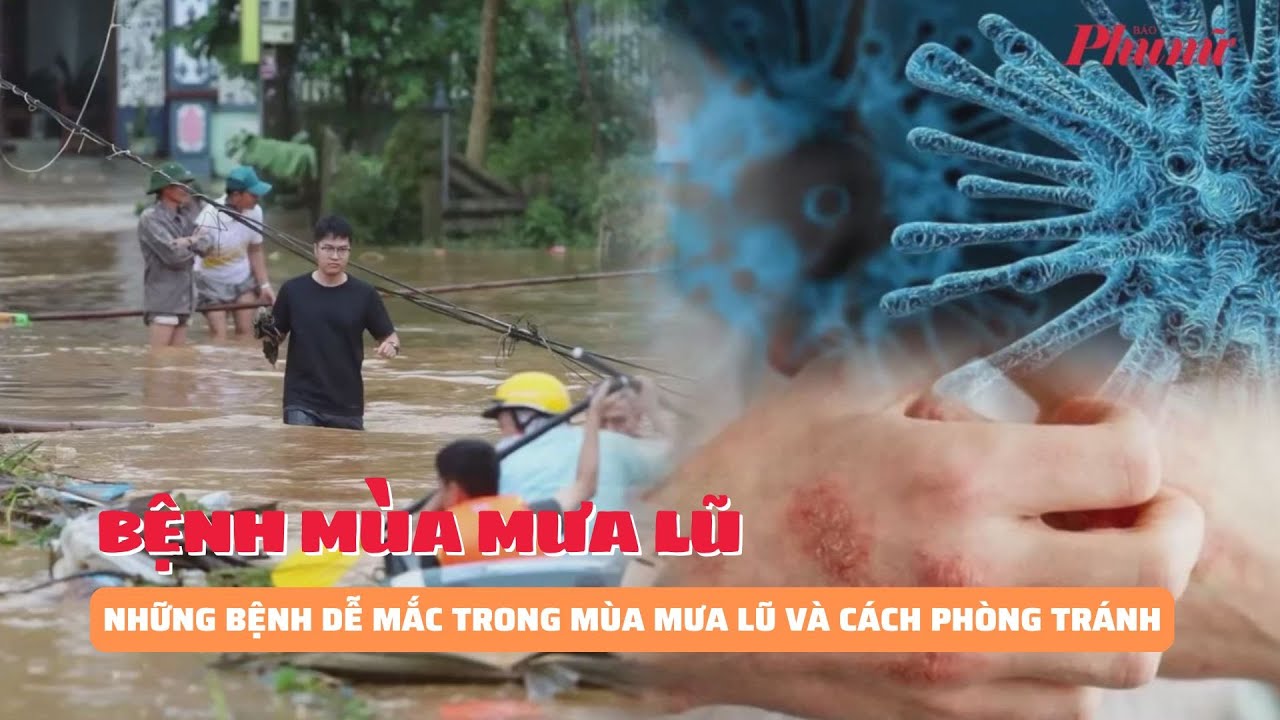 Những bệnh dễ mắc trong mùa mưa lũ và cách phòng tránh | Báo Phụ Nữ