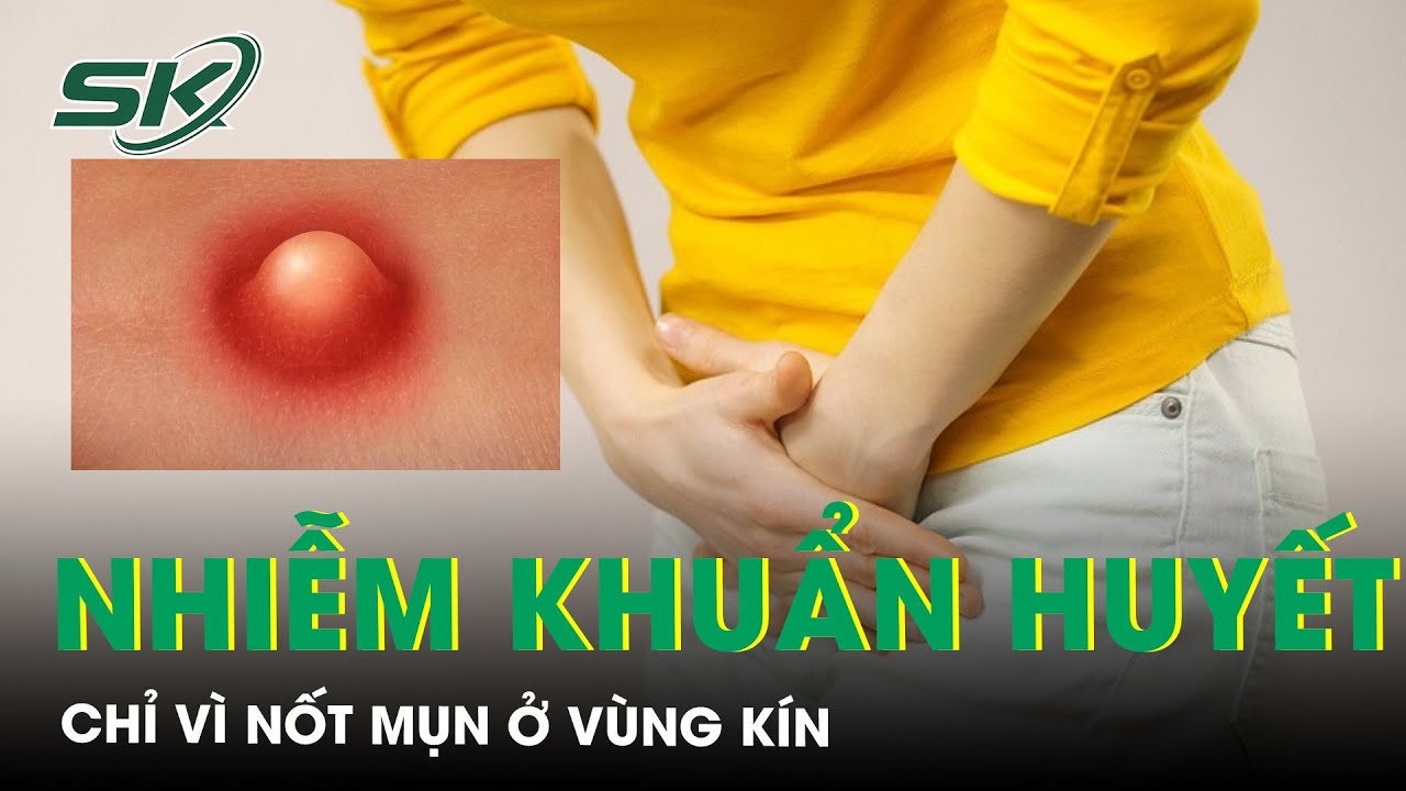 Viêm mô tế bào, nhiễm khuẩn huyết chỉ vì nốt mụn ở vùng kín | SKĐS