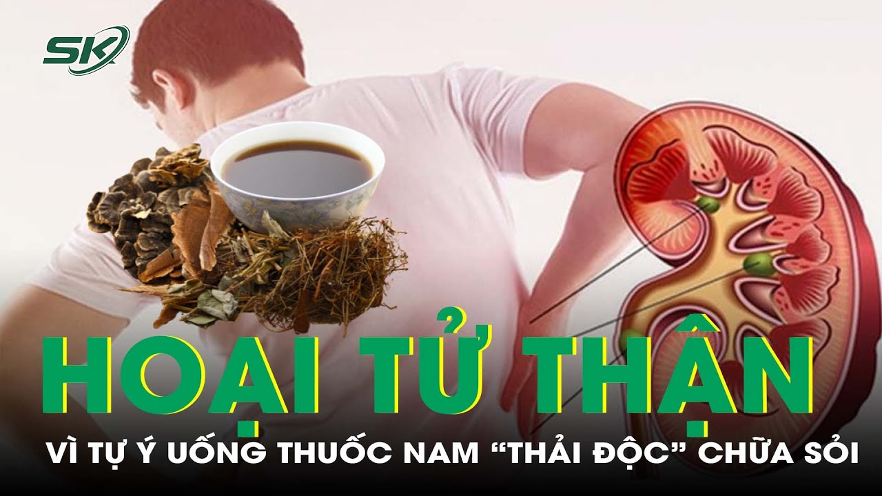 Hoại Tử Thận Vì Tự Ý Uống Thuốc Nam “Thải Độc”Chữa Sỏi I SKĐS