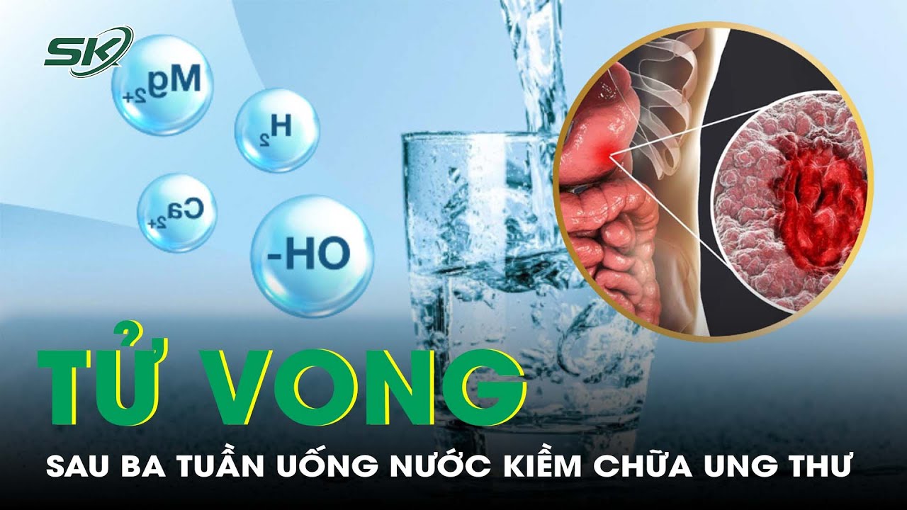 Tử Vong Sau 3 Tuần Từ Chối Điều Trị Ung Thư, Về Nhà Uống Nước Kiềm Để Thu Nhỏ U | SKĐS