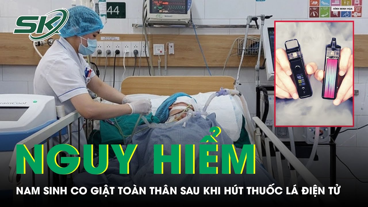 Nam Sinh Mất Ý Thức, Co Giật Toàn Thân Sau Khi Hút Thuốc Lá Điện Tử | SKĐS