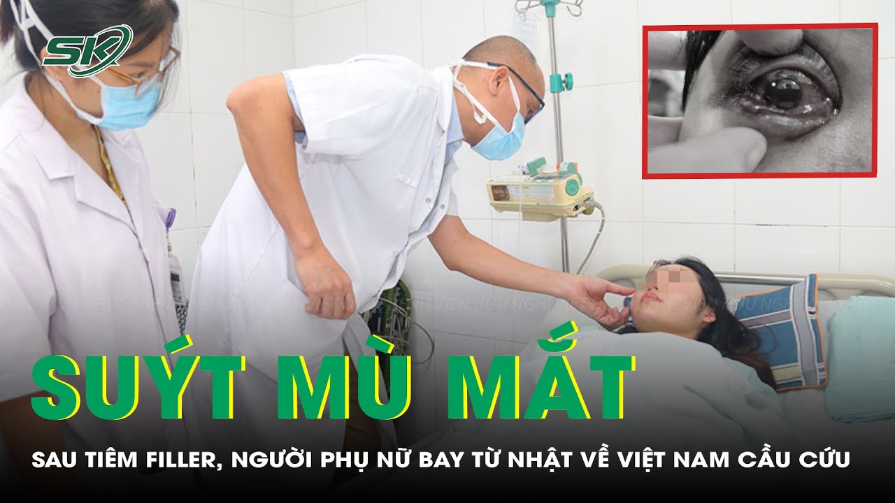 Suýt Mù Mắt Sau Tiêm Filler, Người Phụ Nữ Bay Từ Nhật Về Việt Nam Cầu Cứu | SKĐS