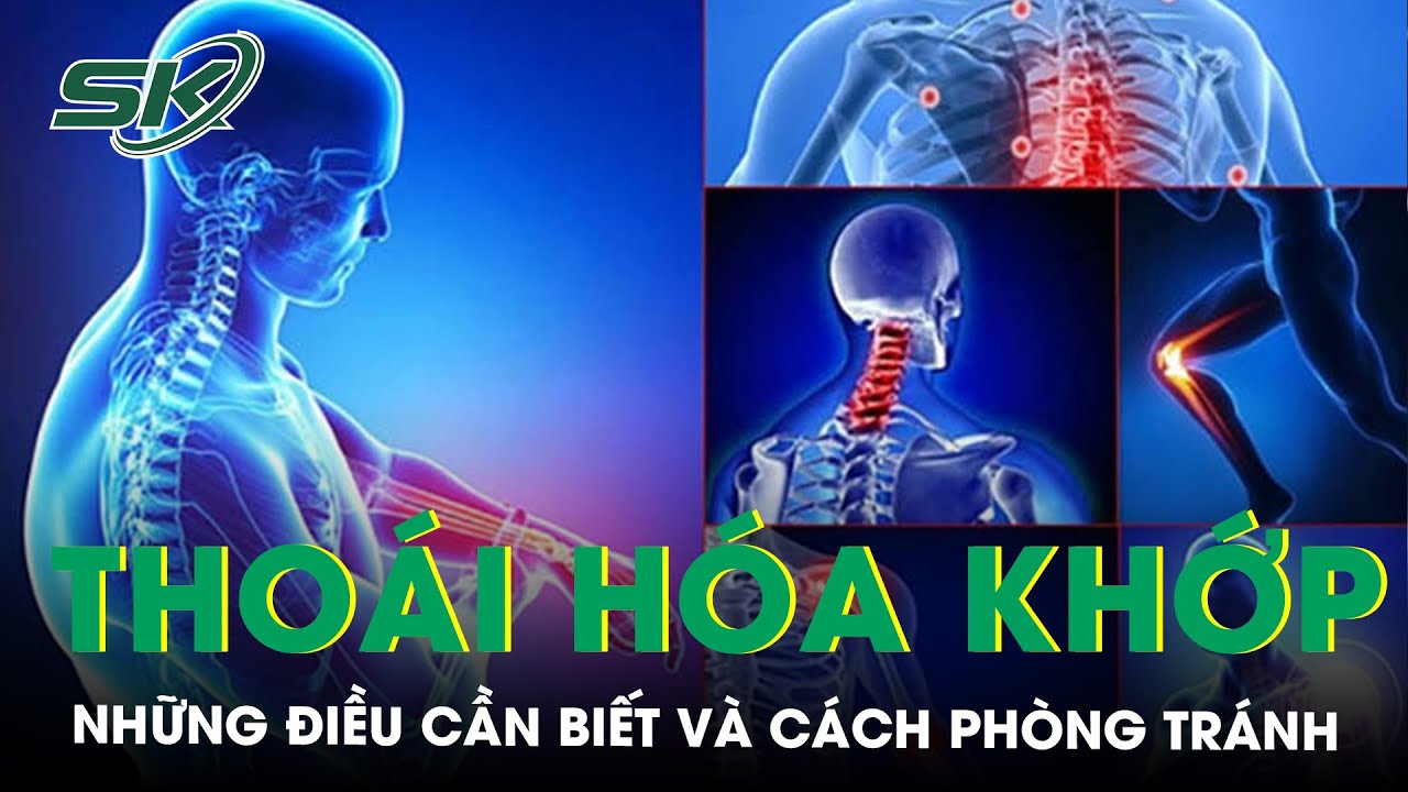 Thoái Hóa Khớp: Những Điều Cần Biết Và Cách Phòng Tránh | SKĐS