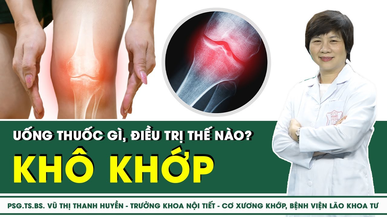 Khô khớp uống thuốc gì, điều trị thế nào? | SKĐS