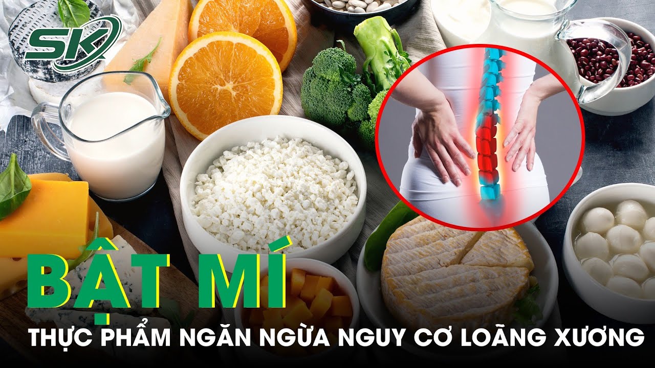 Nên Bổ Sung Thực Phẩm Gì Để Ngăn Ngừa Nguy Cơ Loãng Xương? | SKĐS