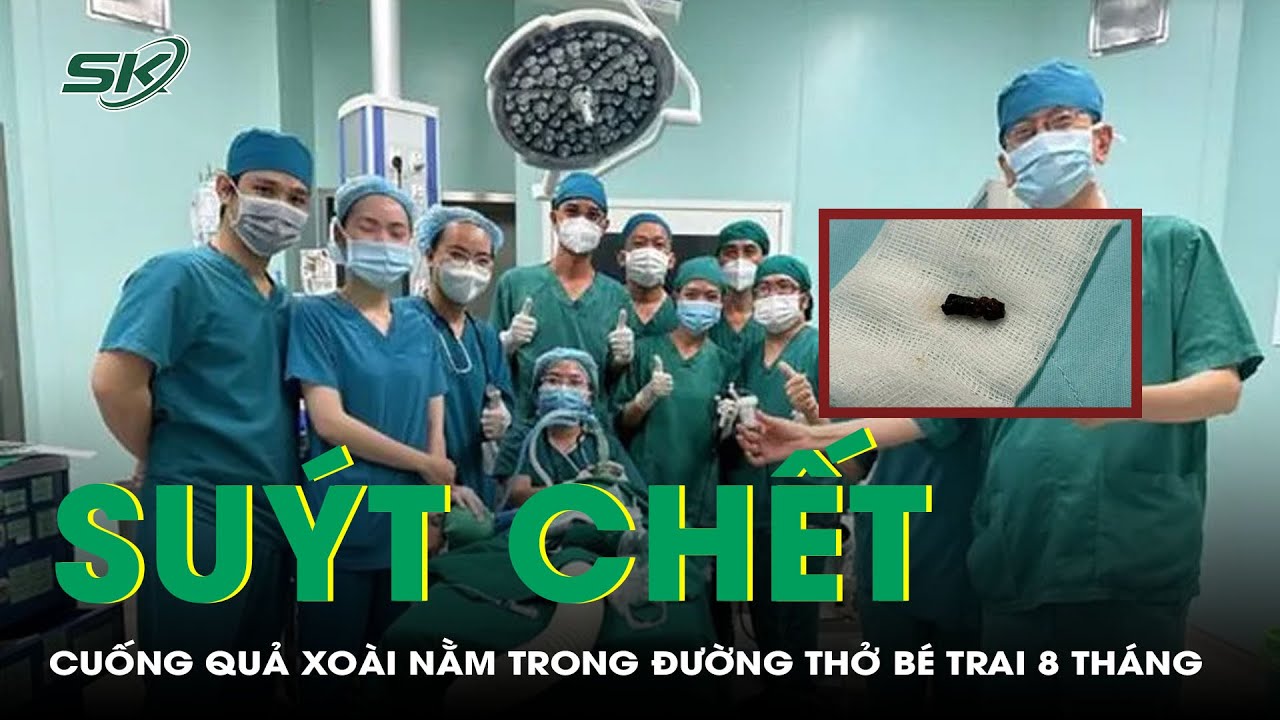 Suýt Chết: Cuống Quả Xoài Nằm Trong Đường Thở Bé Trai 8 Tháng | SKĐS