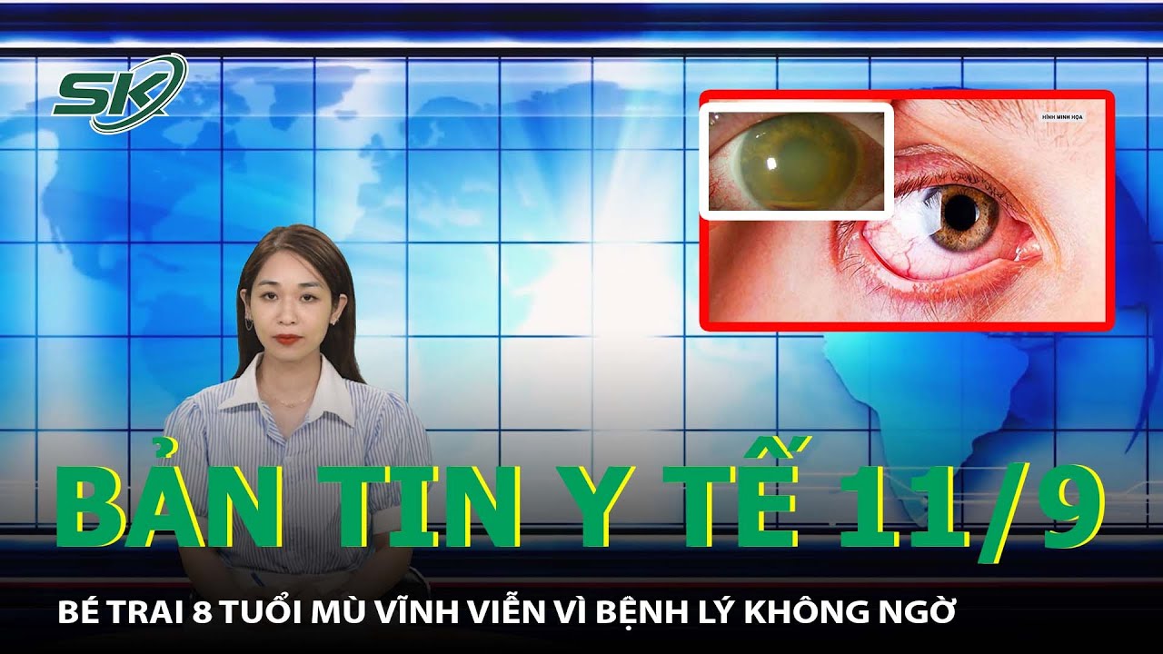 Bản Tin Y Tế 11/9: Bé Trai 8 Tuổi Mù Vĩnh Viễn Vì Bệnh Lý Không Ngờ | SKĐS