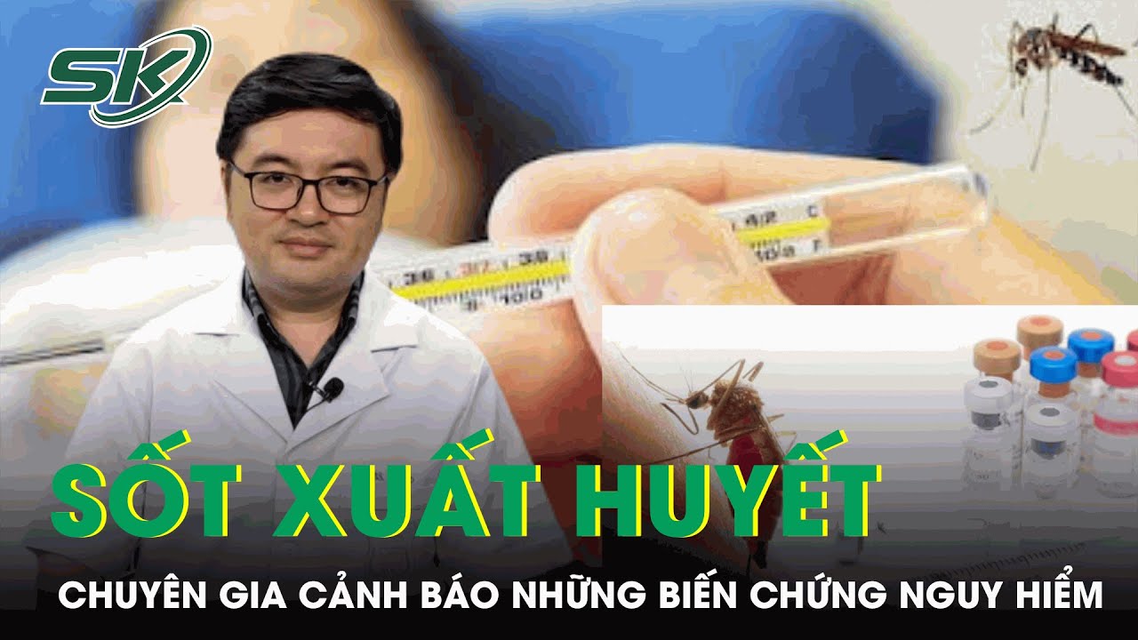 Chuyên Gia Cảnh Báo Những Biến Chứng Nguy Hiểm Của Bệnh Sốt Xuất Huyết | SKĐS