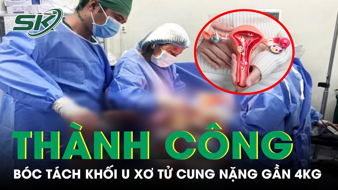 Bóc Tách Khối U Xơ Tử Cung Nặng Gần 4 Kg Cho Bệnh Nhân | SKĐS