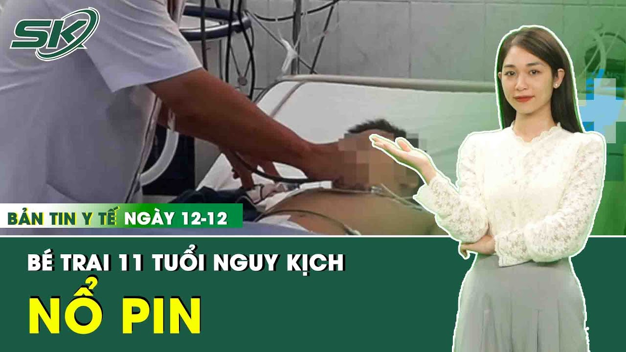 Bản Tin Y Tế 22/12: Bé Trai 11 Tuổi Ở Bình Định Nhập Viện, Nguy Kịch Do Pin Phát Nổ | SKĐS