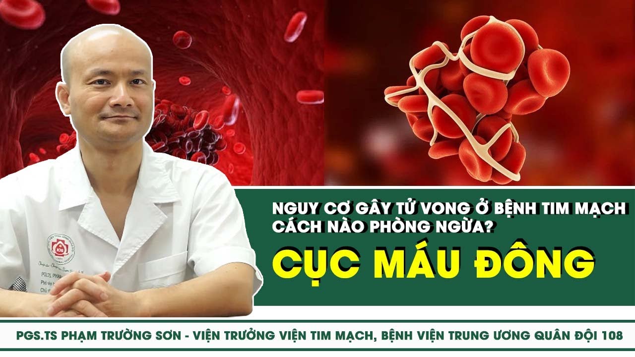 Cục máu đông - Nguy cơ gây tử vong ở bệnh tim mạch cách nào phòng ngừa? | SKĐS