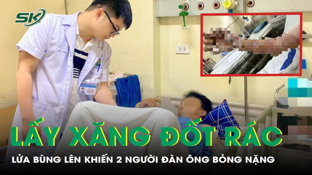 Dùng Xăng Đốt Rác, Lửa Bùng Lên Khiến 2 Người Đàn Ông Bỏng Nặng | SKĐS