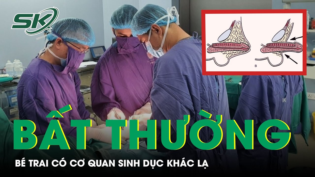 Bất Thường Cơ Quan Sinh Dục Khiến Bé Trai Phải Phẫu Thuật | SKĐS