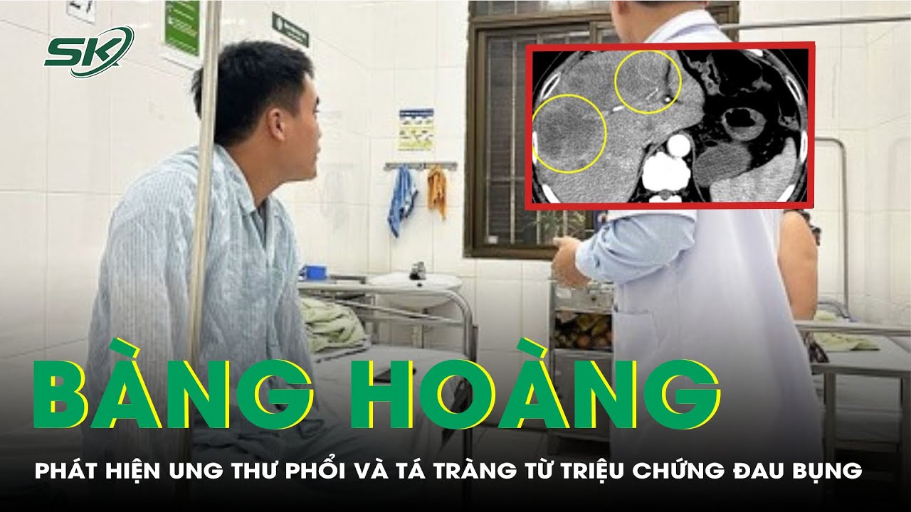 Bàng Hoàng: Phát Hiện Ung Thư Phổi Và Tá Tràng Từ Triệu Chứng Đau Bụng | SKĐS