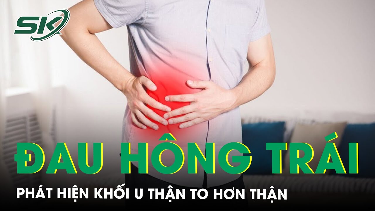 Đau vùng hông trái phát hiện khối u thận to hơn thận | SKĐS