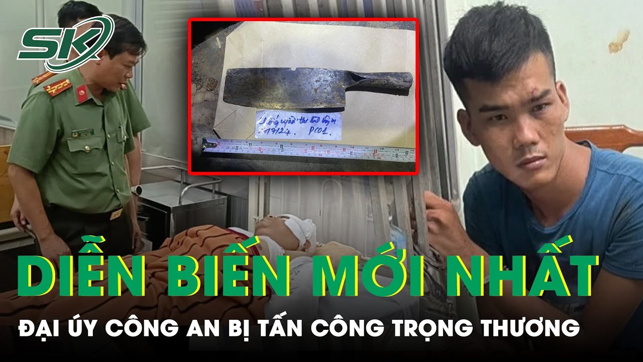 Diễn Biến Sức Khỏe Vụ Đại Úy Công An Bị Tấn Công Trọng Thương | SKĐS