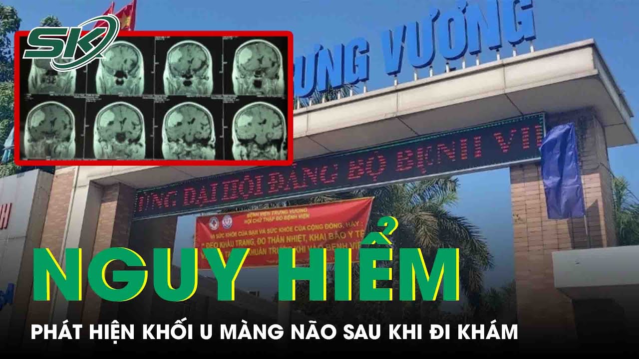 Đi Khám Đau Đầu, Phát Hiện Khối U Màng Não To Hơn Trứng Vịt | SKĐS