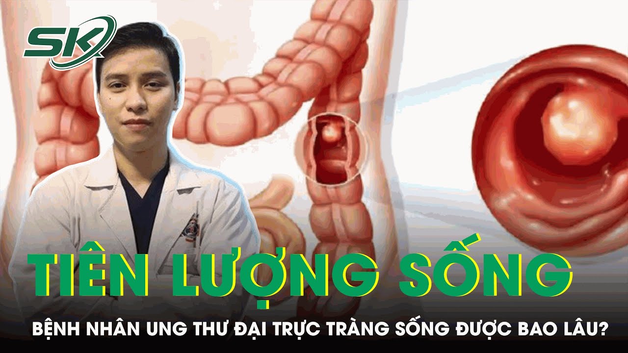 Tiên Lượng Sống Của Người Bệnh Ung Thư Đại Trực Tràng | SKĐS