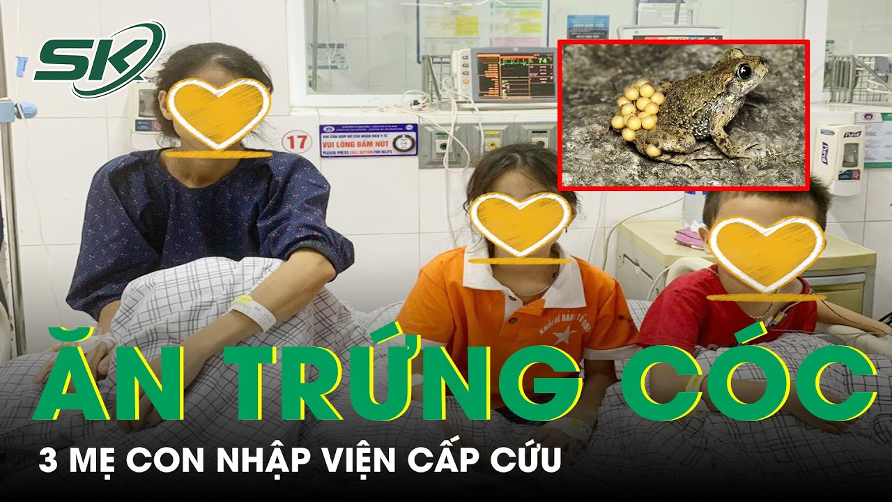 3 Mẹ Con Nhập Viện Cấp Cứu Sau Khi Ăn Thịt Trứng Cóc | SKĐS