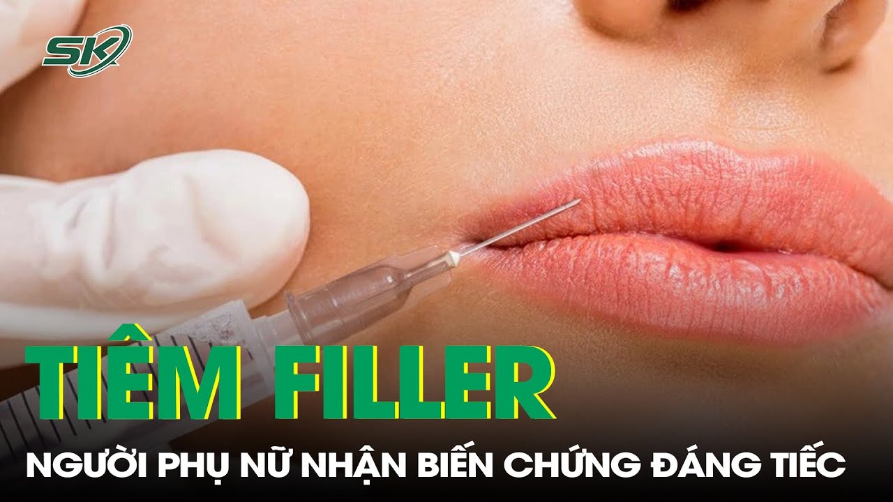 Người Phụ Nữ Gặp Biến Chứng Sau Khi Tiêm Filler Làm Đẹp | SKĐS