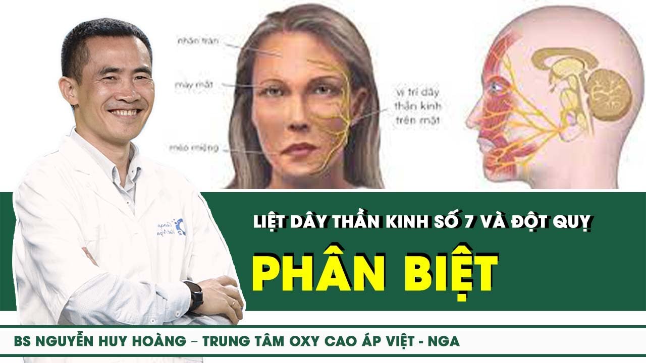 Phân biệt liệt dây thần kinh số 7 và đột quỵ | SKĐS