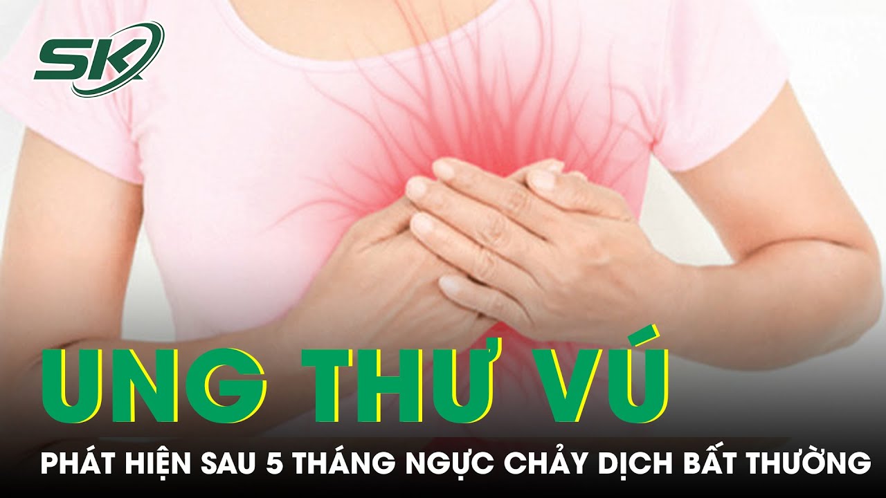 Phát Hiện Ung Thư Sau 5 Tháng Ngực Chảy Dịch Bất Thường | SKĐS