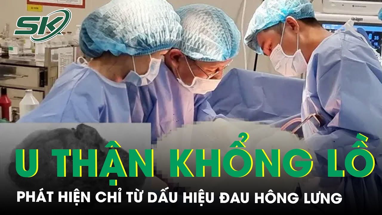 Đau Vùng Hông Lưng Trái Phát Hiện Khối U Thận To Hiếm Gặp | SKĐS