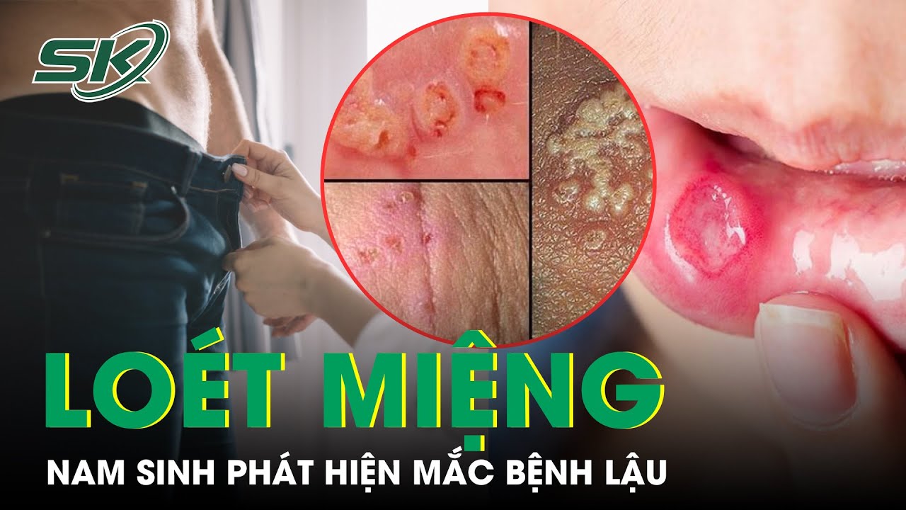 Lầm tưởng tai hại về quan hệ bằng miệng, nam sinh hối không kịp | SKĐS