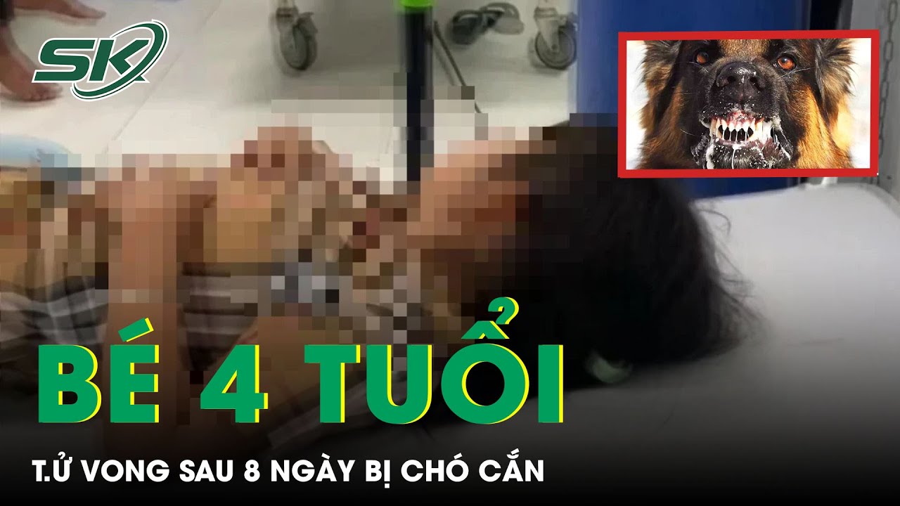 Bé 4 Tuổi T.ử Vong Sau 8 Ngày Bị Chó Cắn | SKĐS