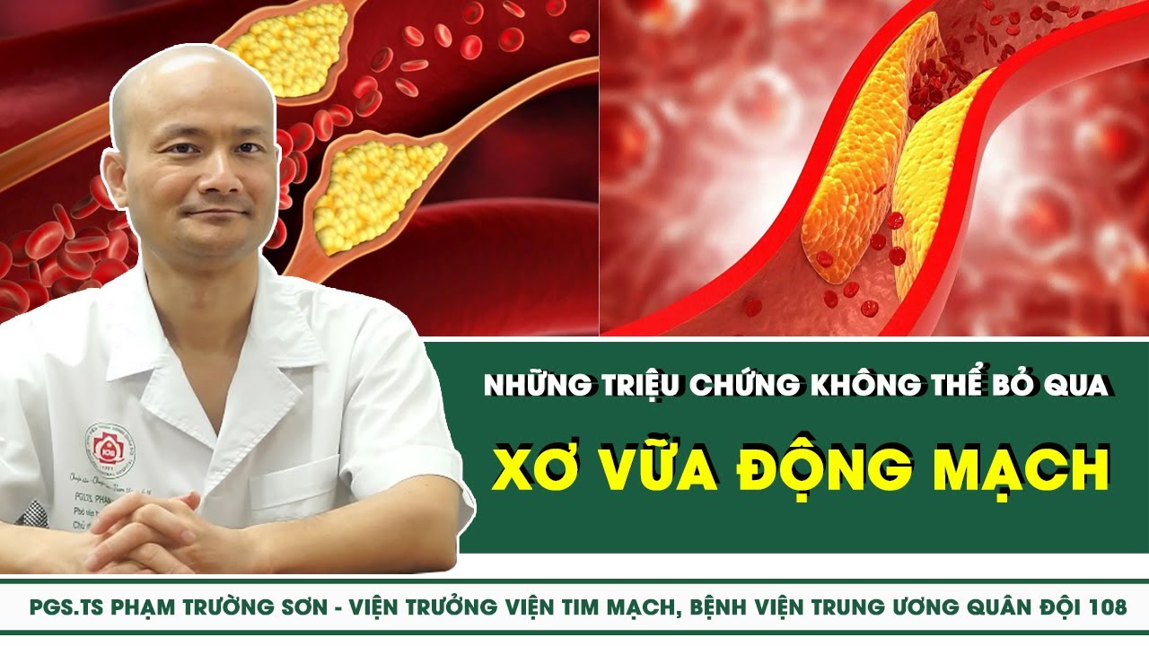 Xơ vữa động mạch: Những triệu chứng không thể bỏ qua | SKĐS