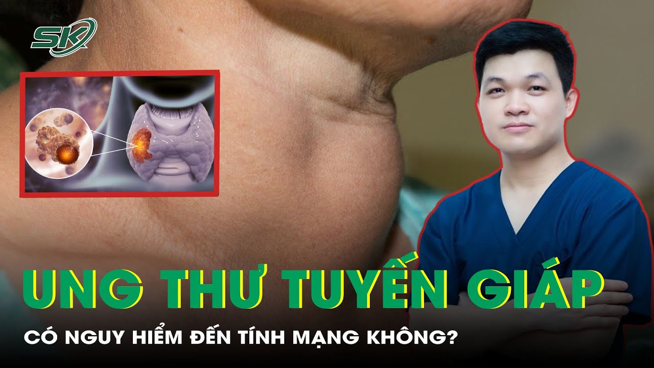 Ung Thư Tuyến Giáp Có Nguy Hiểm Đến Tính Mạng Không? | SKĐS