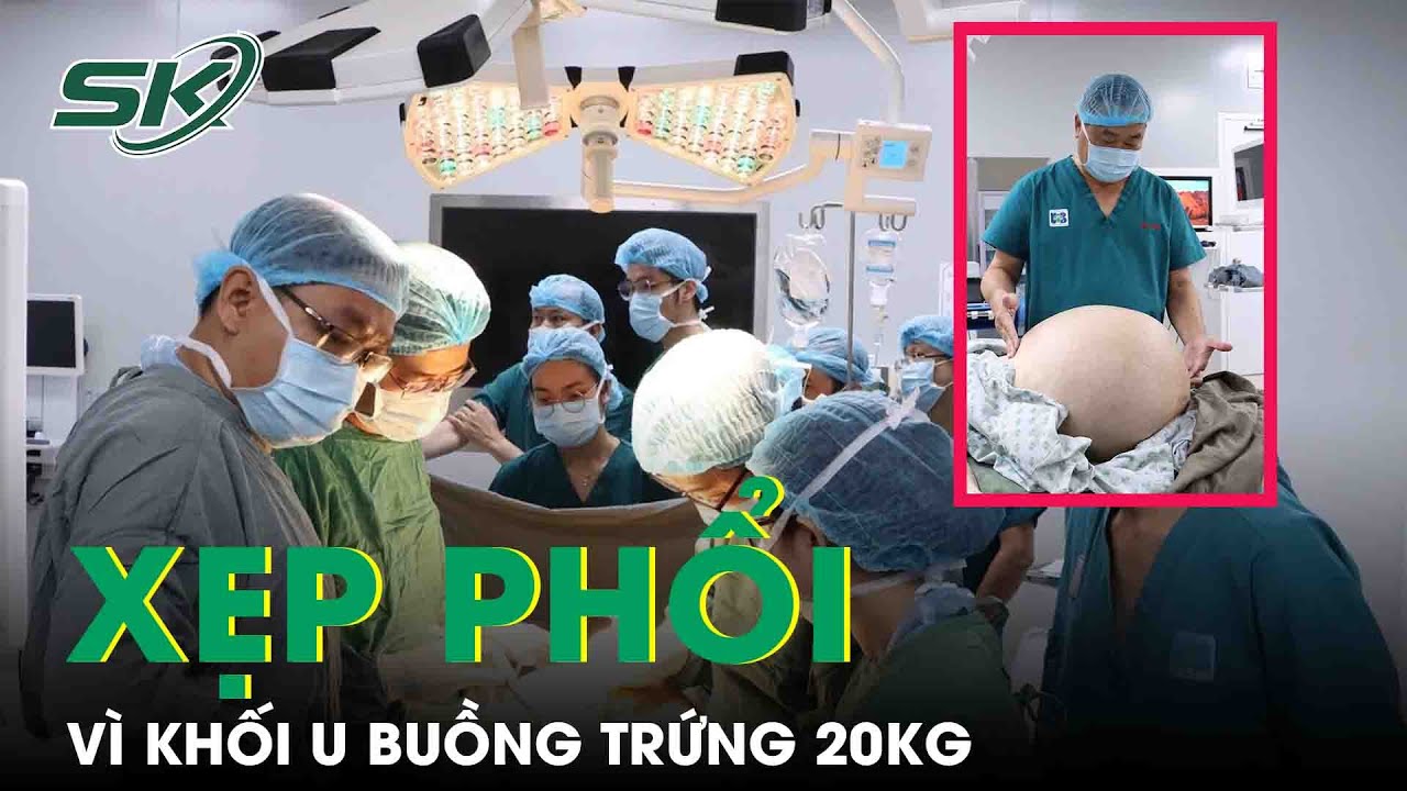 Bụng To Như Ễnh Ương, Xẹp Phổi Vì Khối U Buồng Trứng 20Kg | SKĐS