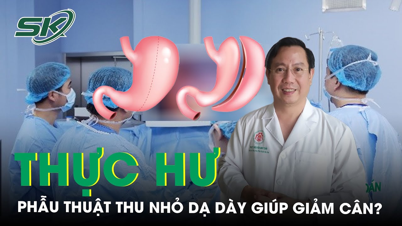 Thực Hư Phẫu Thuật Thu Nhỏ Dạ Dày Giúp Giảm Cân? | SKĐS