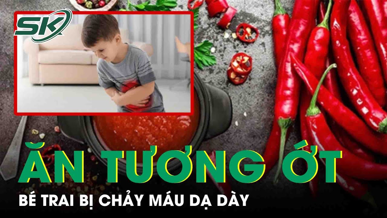 Thường Xuyên Ăn Tương Ớt, Bé Trai Bị Chảy Máu Dạ Dày | SKĐS