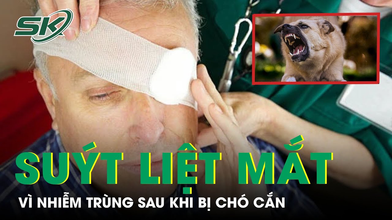 Suýt Liệt Mắt Vì Nhiễm Trùng Sau Khi Bị Chó Cắn | SKĐS